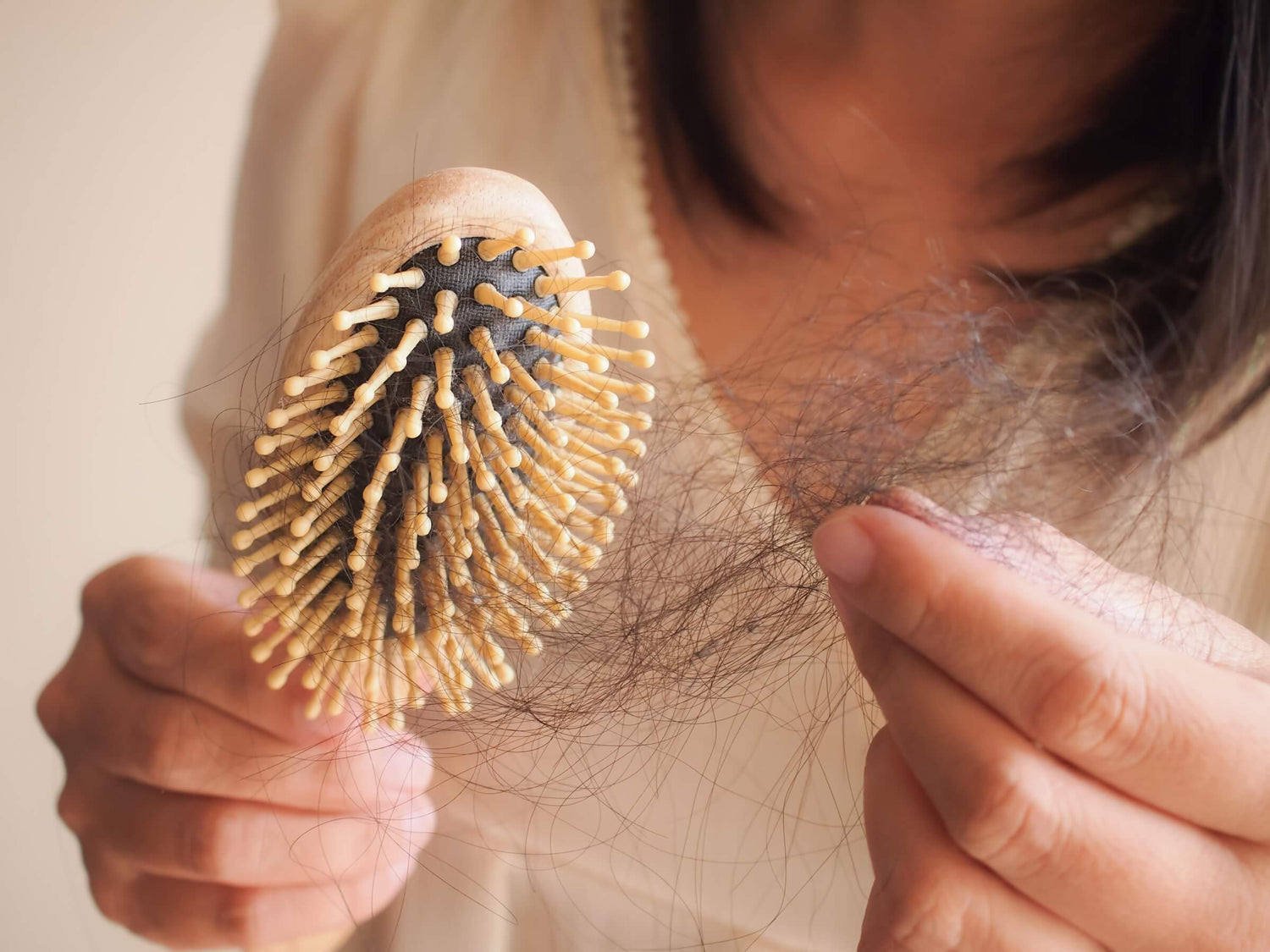 Close-up of a hairbrush filled with loose hair, highlighting alopecia and hair loss issues