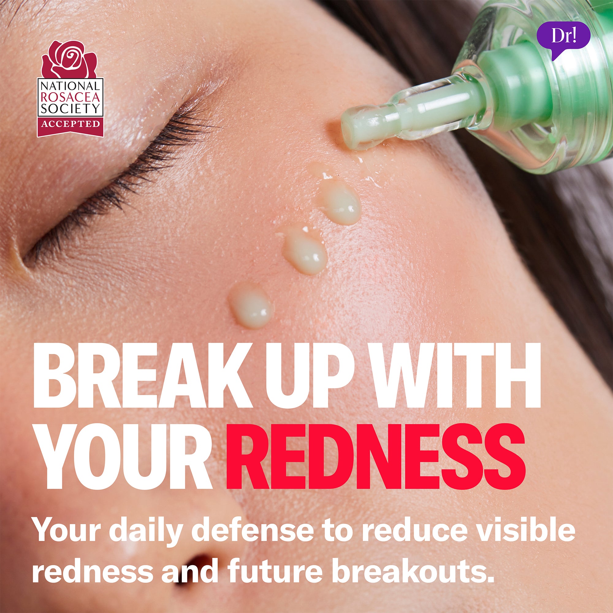 Left Un-Red Reducer Serum texture applied to skin with precision applicator. Your daily defense to reduce visible redness.