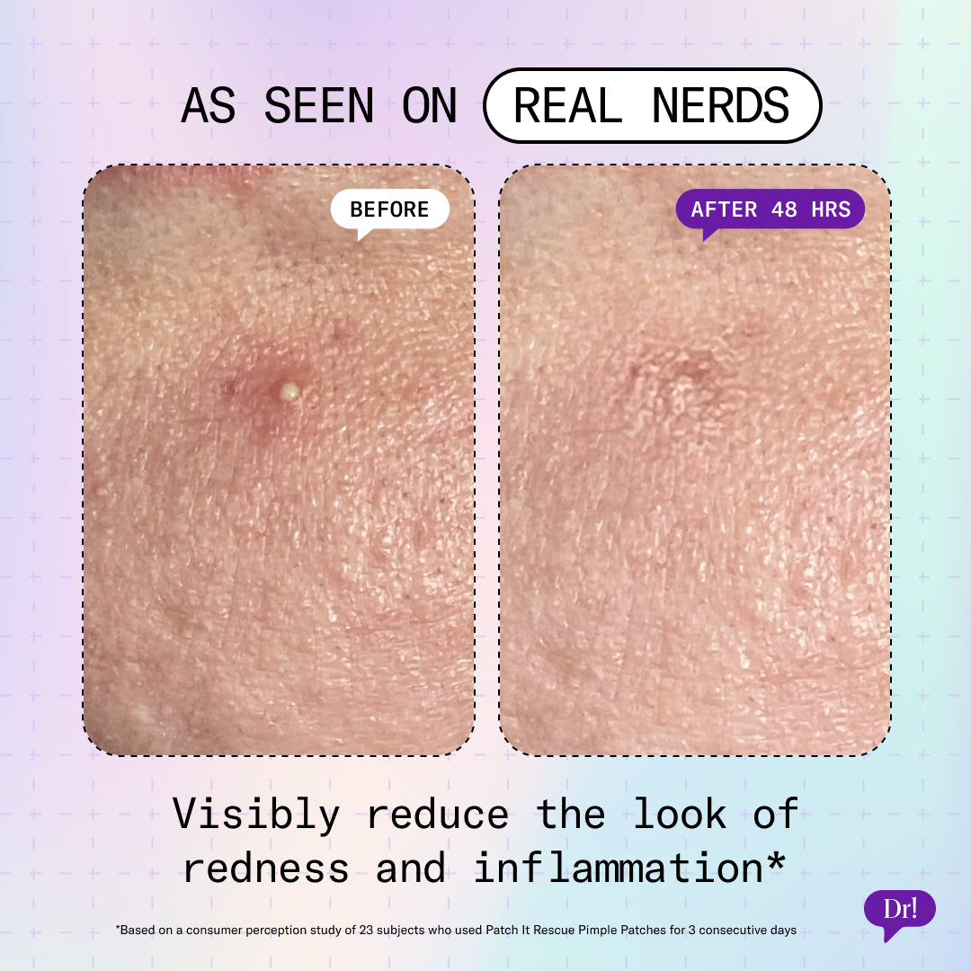 Before and after images showing the visibily reduced look of redness and inflammation.