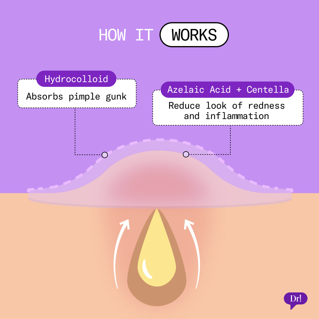 How does it work? Hydrocolloid absorbs pimple gunk and azelaic acid and centella reduces the look of redness and inflammation.