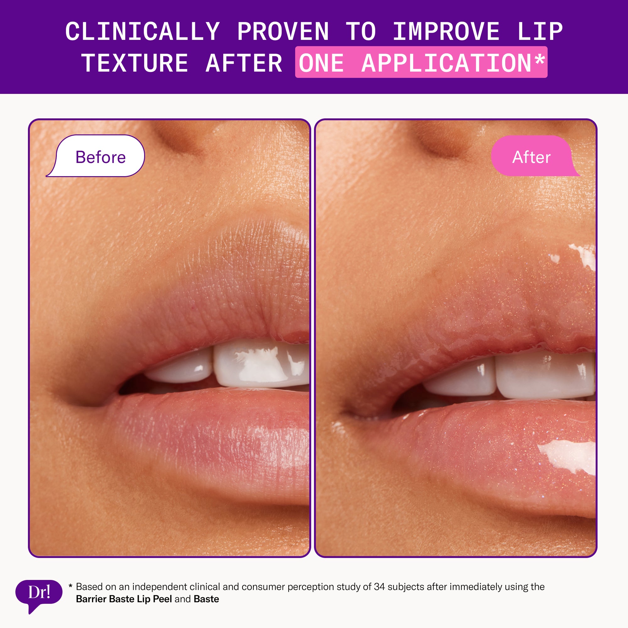 Before and after showing smoother lip texture after using Barrier Baste Lip Peel + Dessert Lip Baste