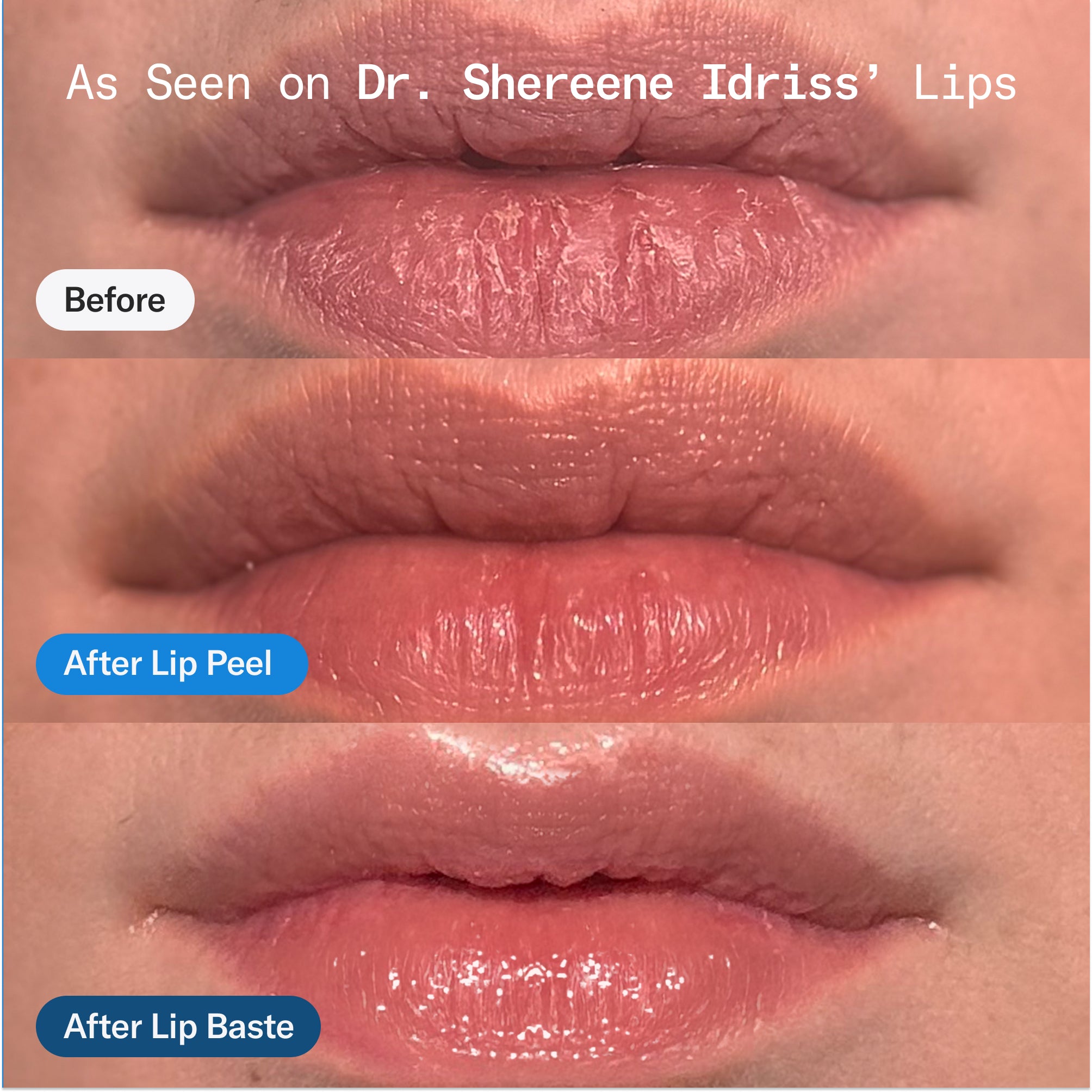 Barrier Baste Lip Basting Duo