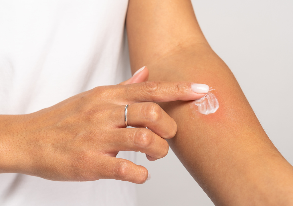 A woman displaying how to patch test skincare on her arm.