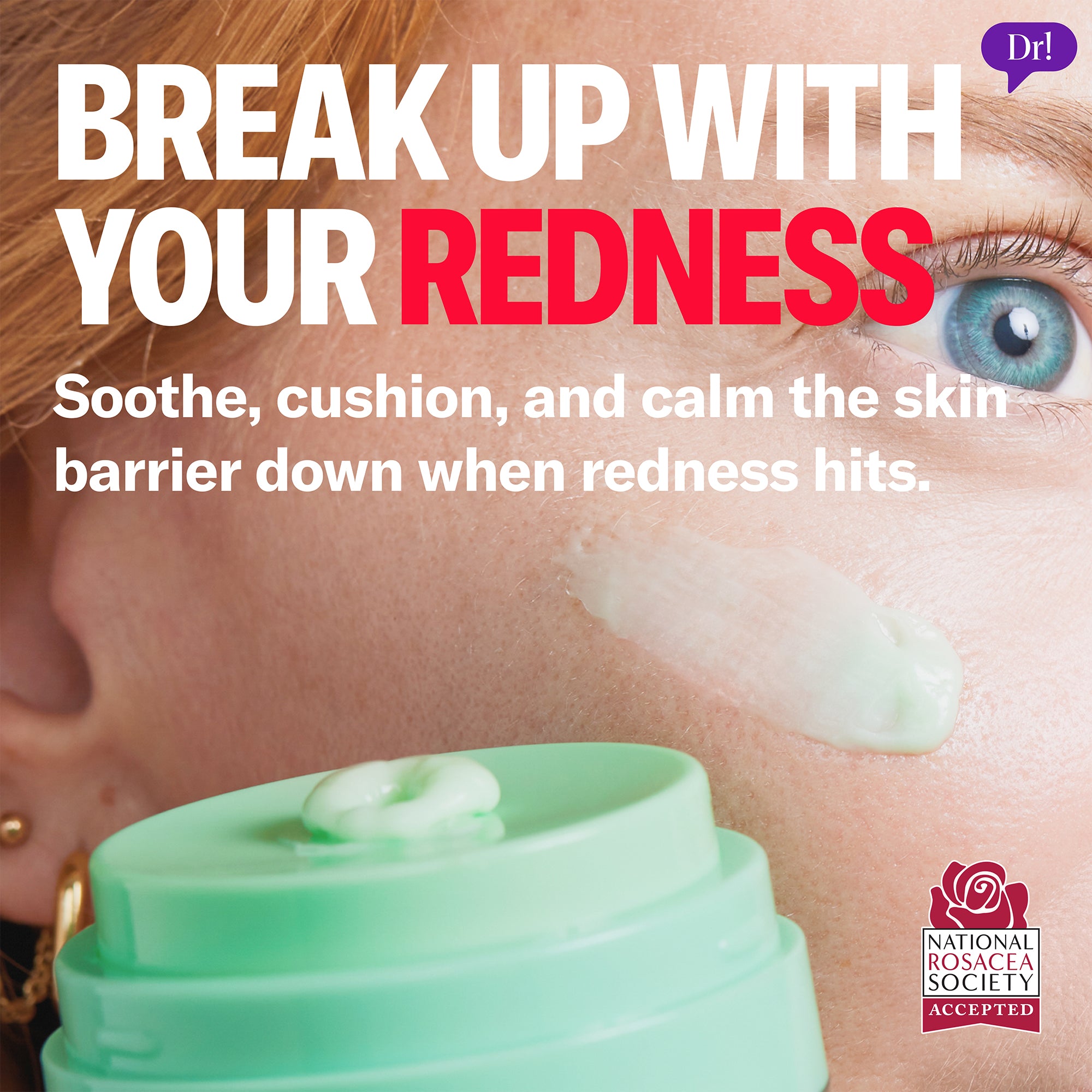 Left Un-Red CalmBack Cream applied to skin to soothe redness and support the skin barrier