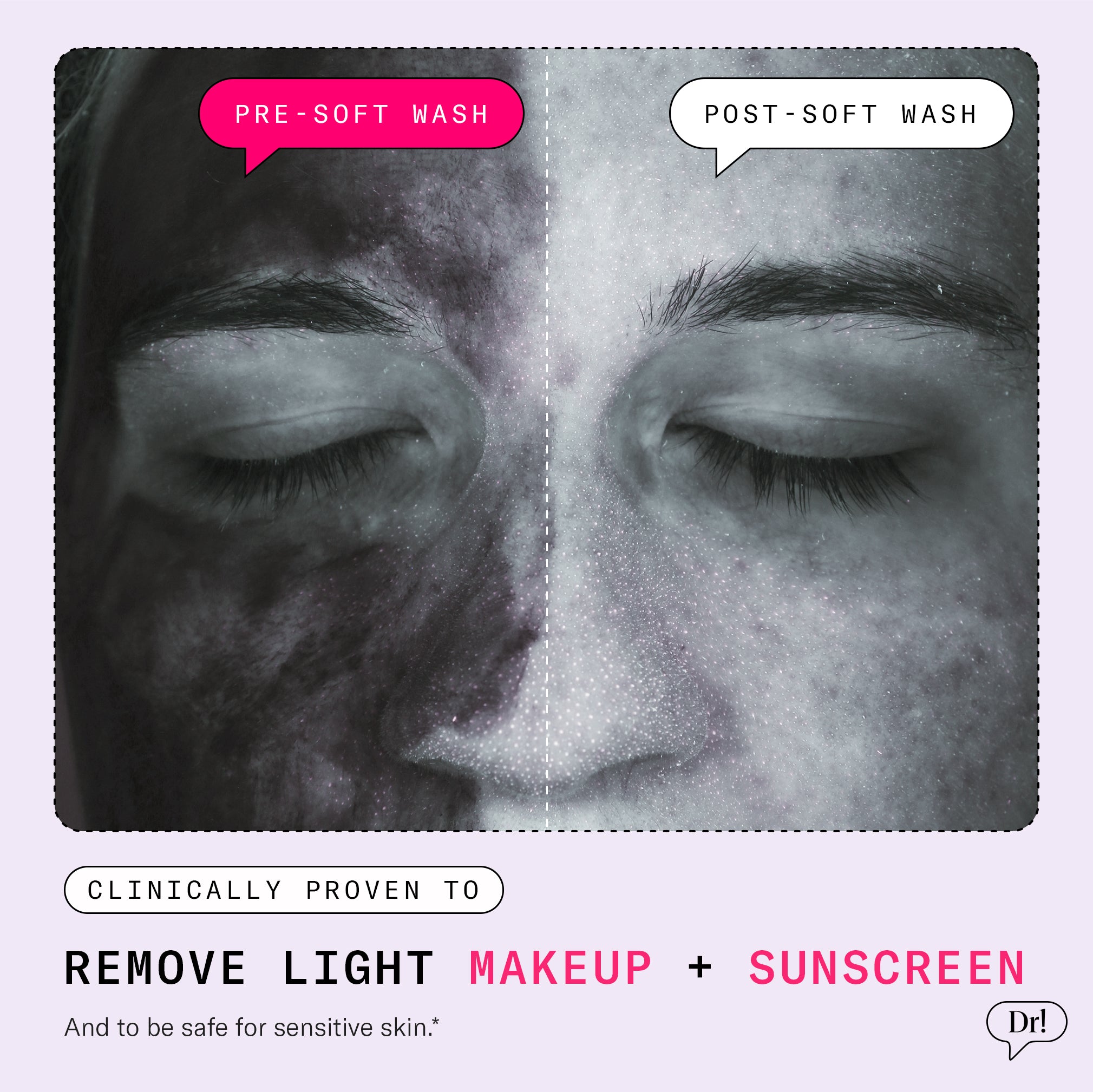 Clinical image with UV camera showing Soft Wash’s makeup and sunscreen removal effectiveness