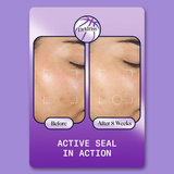 Active Seal Playing Card Before and After