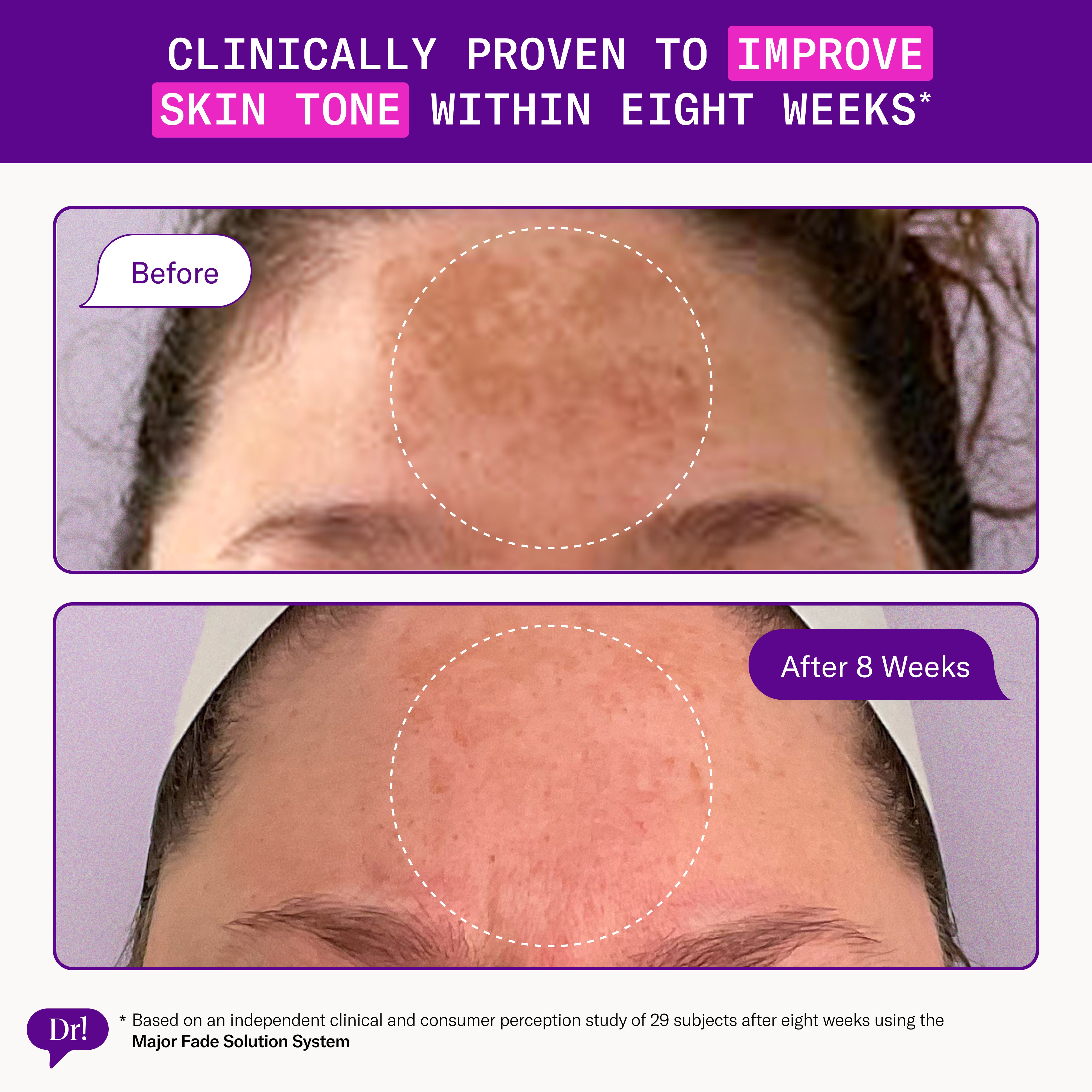 Before and after comparison of skin tone improvement with text claiming clinical provenance.