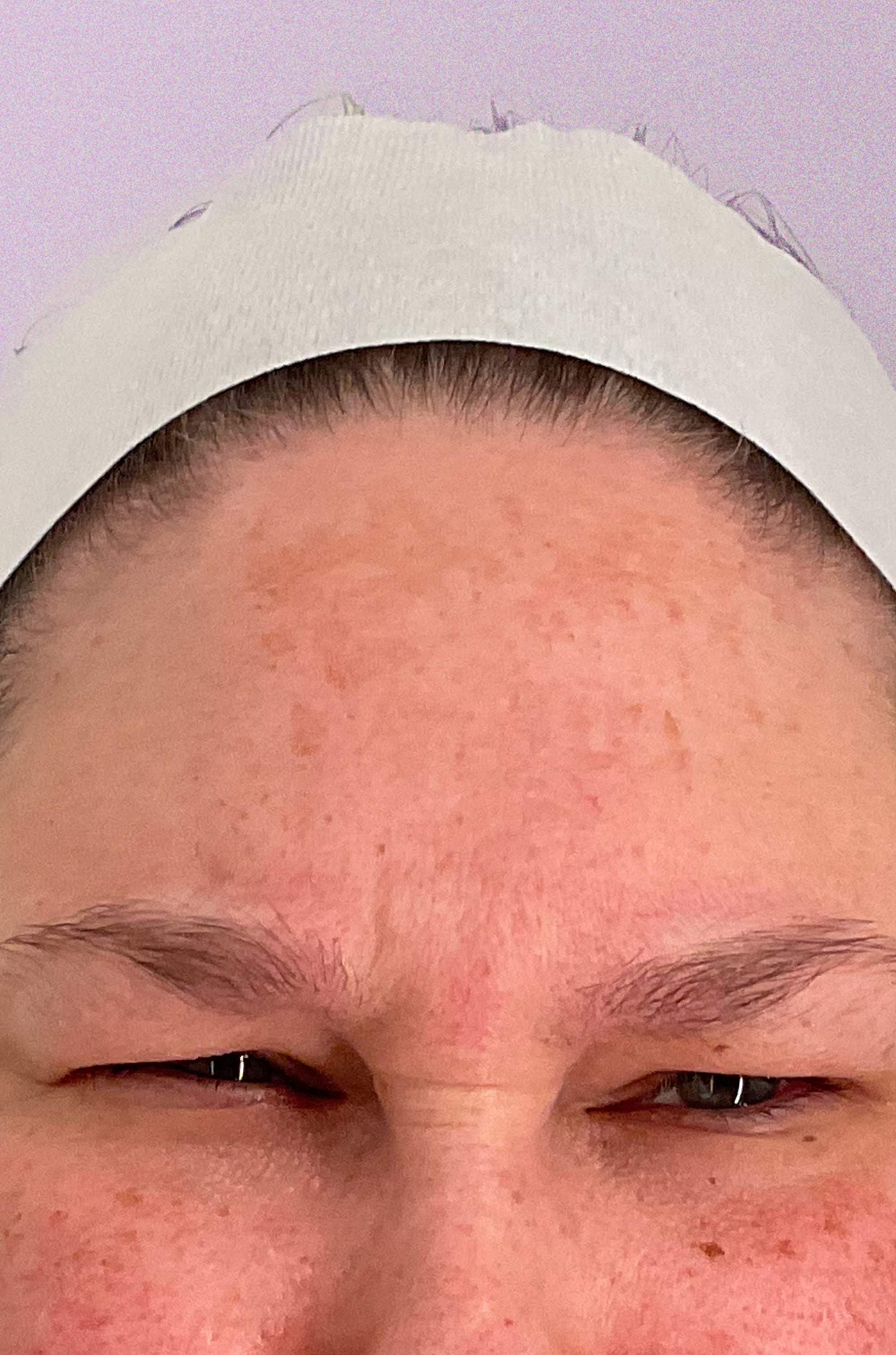 Showing progress after 8 weeks on Major Fade