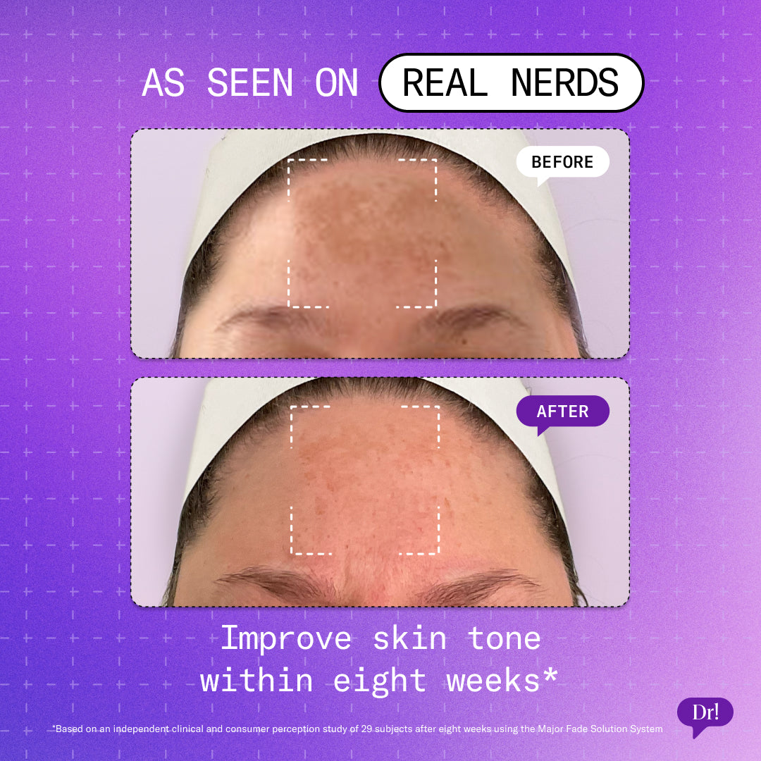 before and after of customer using the Major Fade Solution System