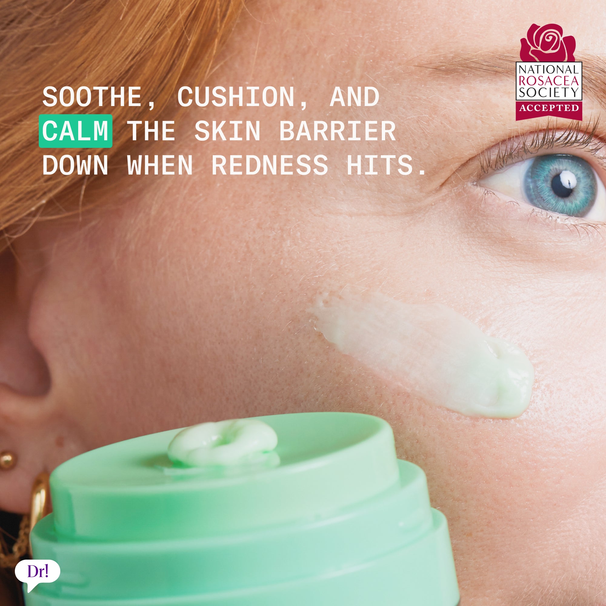 Left Un-Red CalmBack Cream applied to sensitive skin to soothe and calm the skin barrier