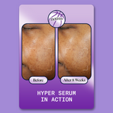 Hyper Serum Playing Card Before and After