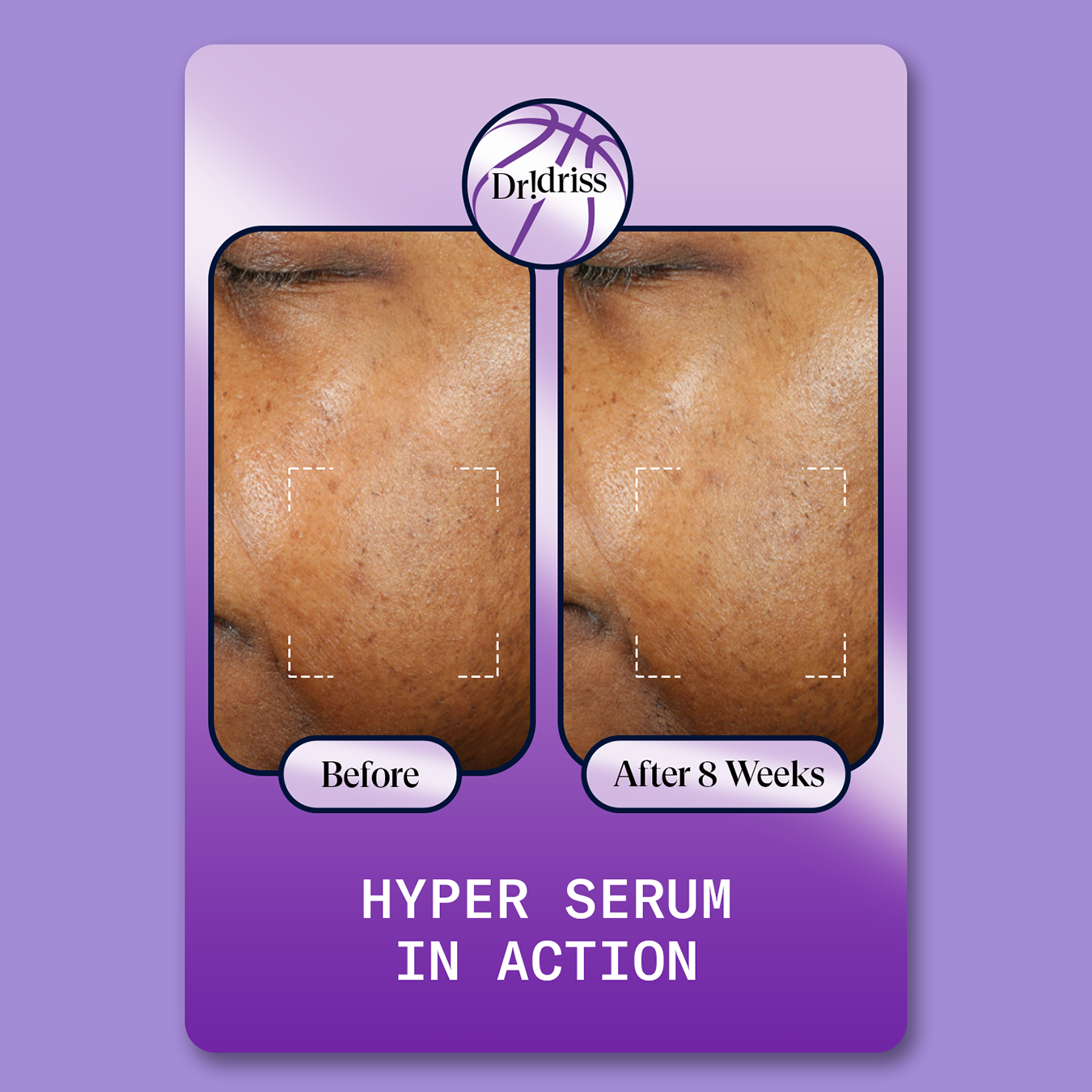 Hyper Serum Playing Card Before and After