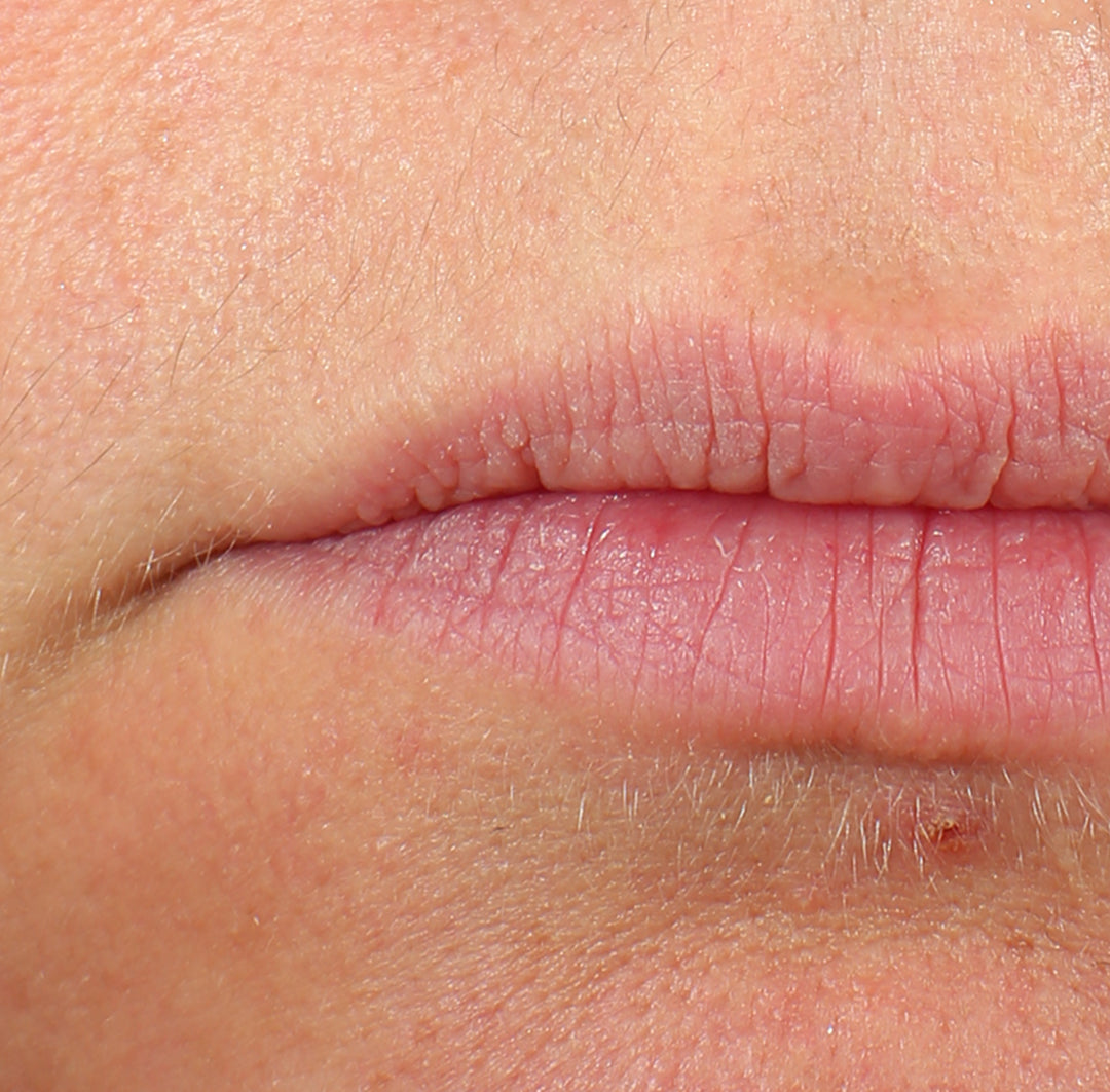 Lips After Using Barrier Baste Lip Basting Duo