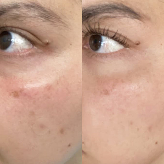 Before and after shared by Julie
