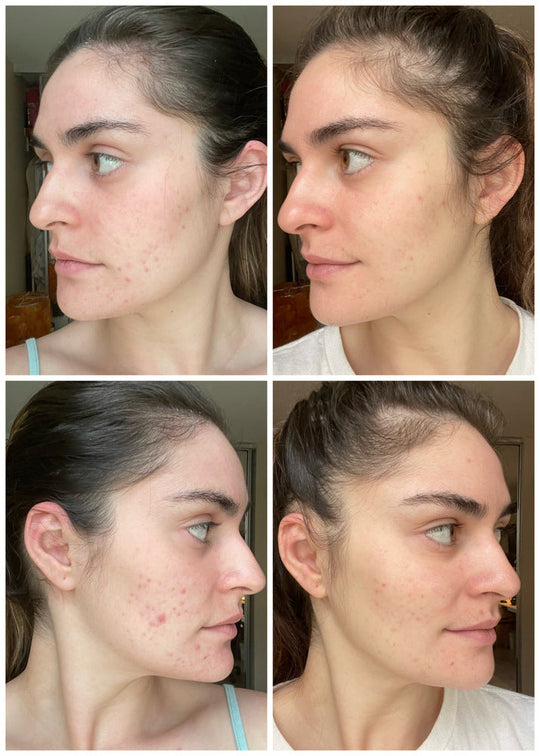 Before and after shared by Edna