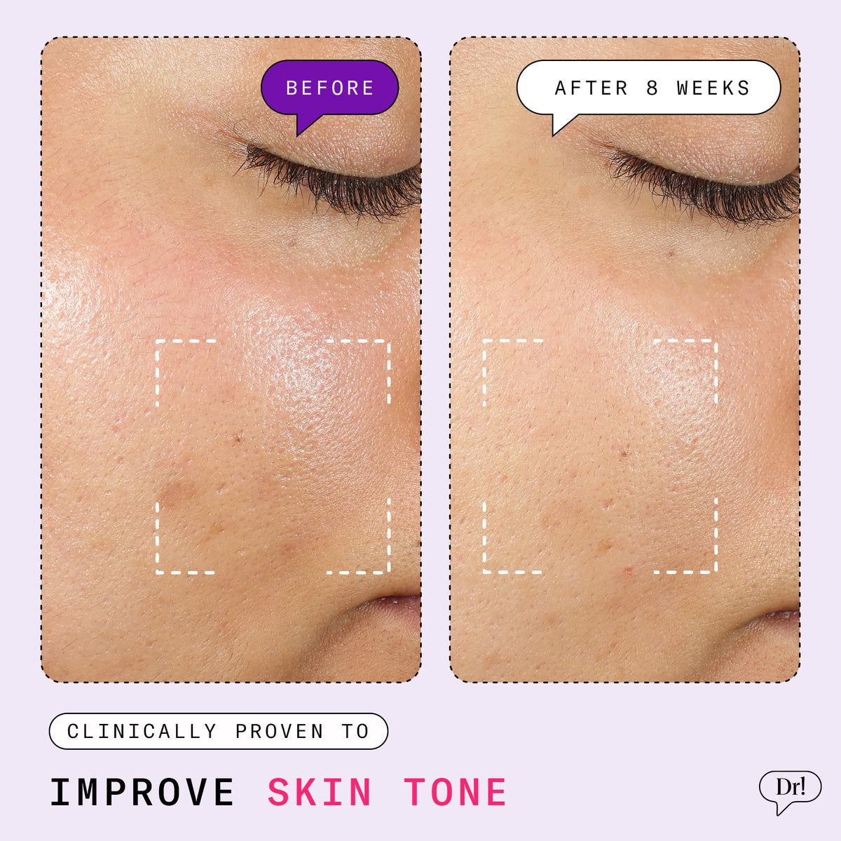 Major Fade Flash Mask | Exfoliating Mask for Uneven Skin Tone – Dr. Idriss